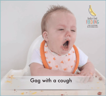 Baby gagging and coughing