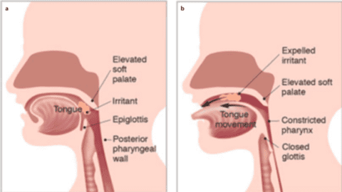 Choking Vs. Gagging: How To Know The Difference And Keep Your Baby Safe 