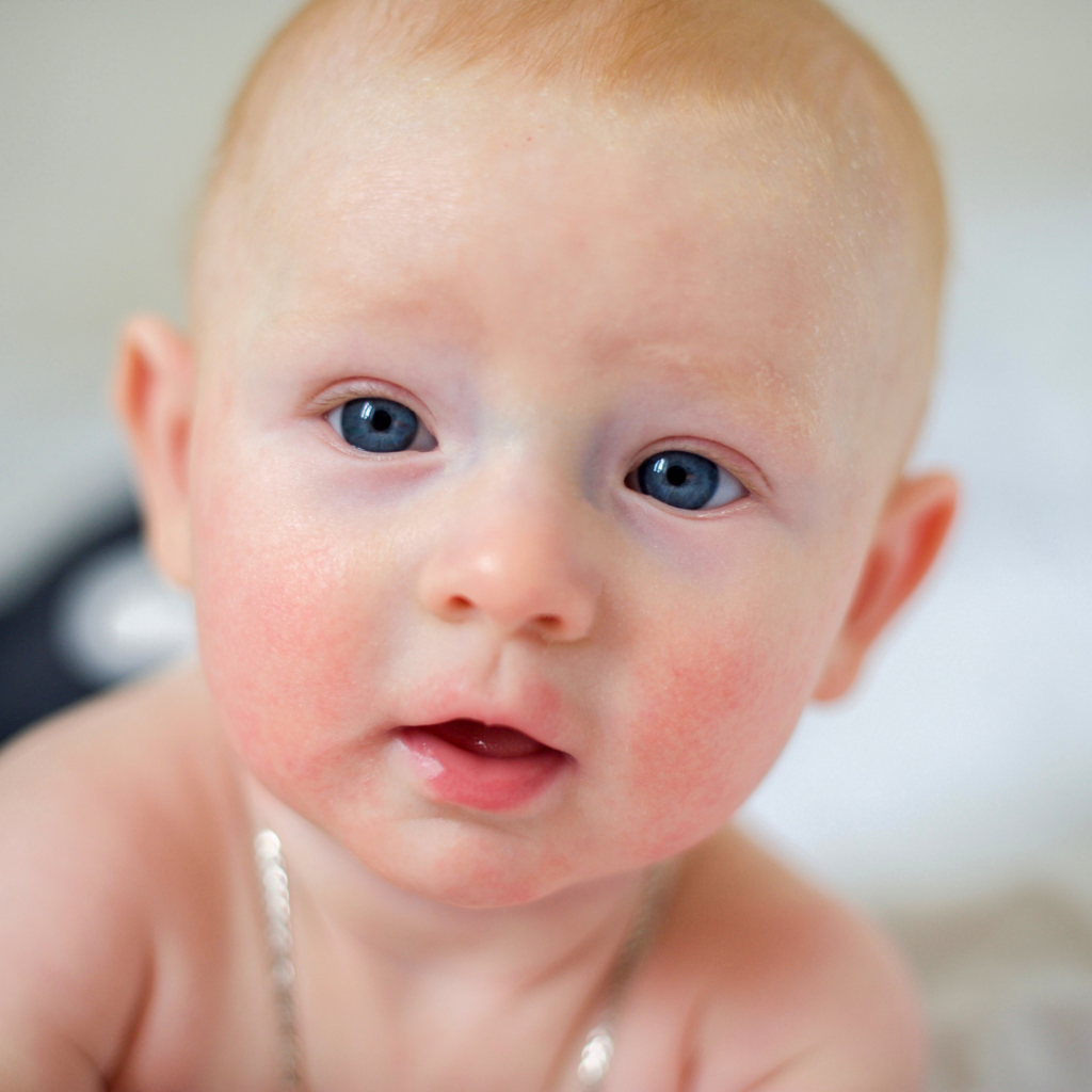 A baby doing tummy time, with very rosy cheeks.